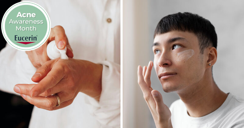 EucerinProACNEQ2 Header 2