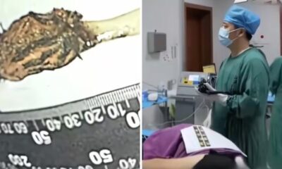 feat image toothbrush